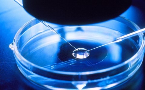 Allt vad du behöver veta om PGD innan du gör en IVF